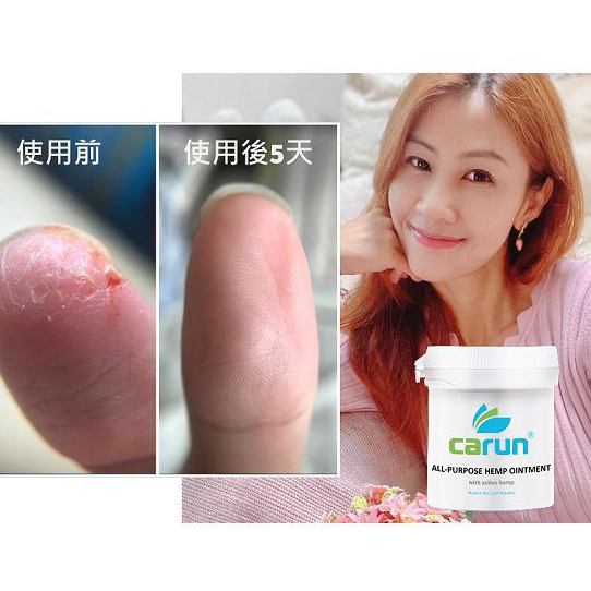 🇨🇿 Carun-卡倫萬用膏 | Kimchihouse 泡菜屋韓國代購