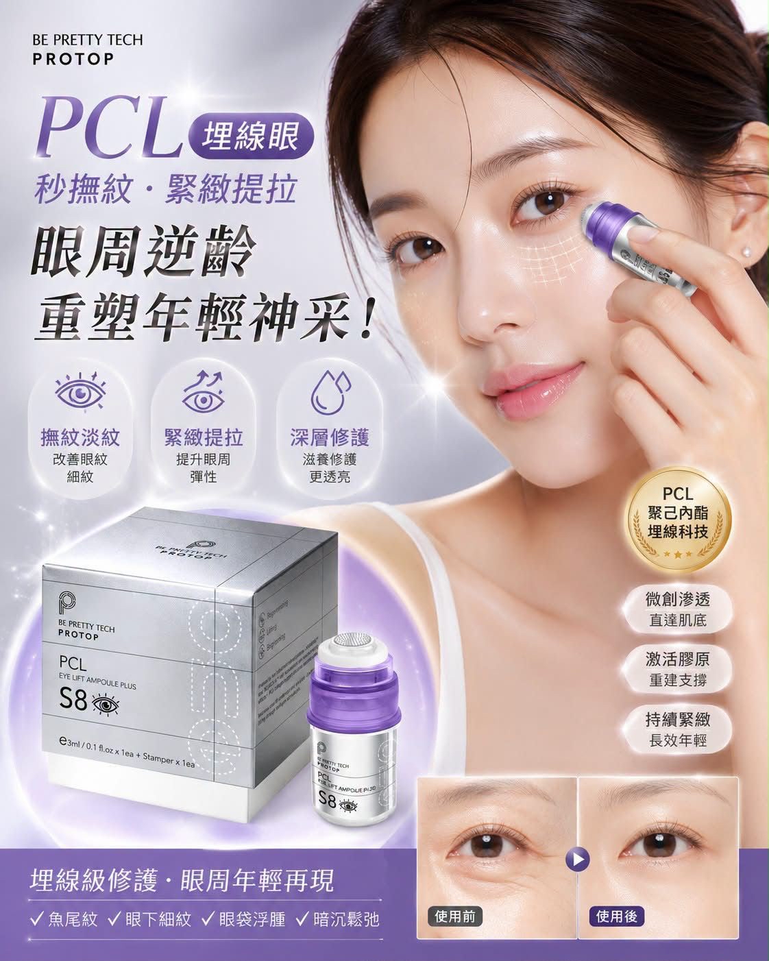 Protop PCL埋線眼 