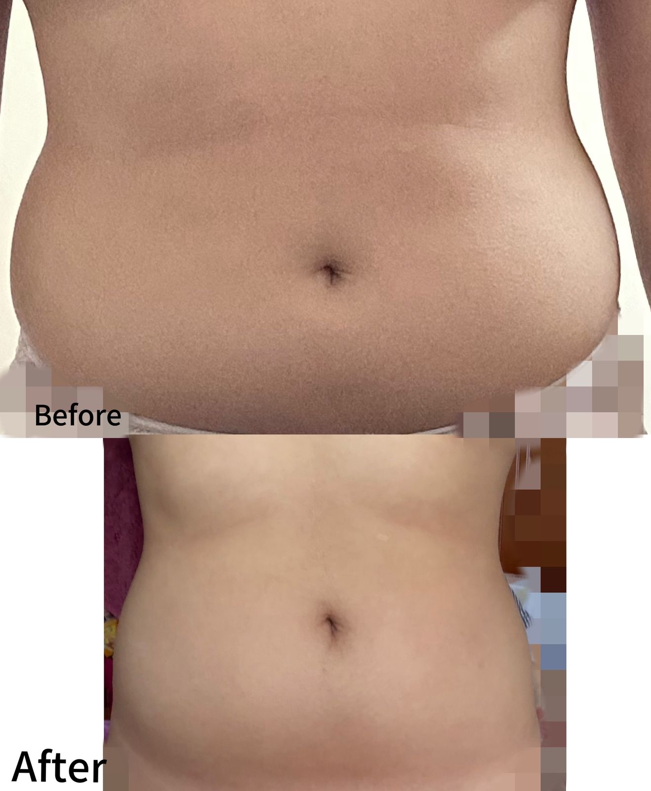 🇲🇾 10 盒 最畅销 VVIP 疗程配套（ 可服用 60-75天 ）