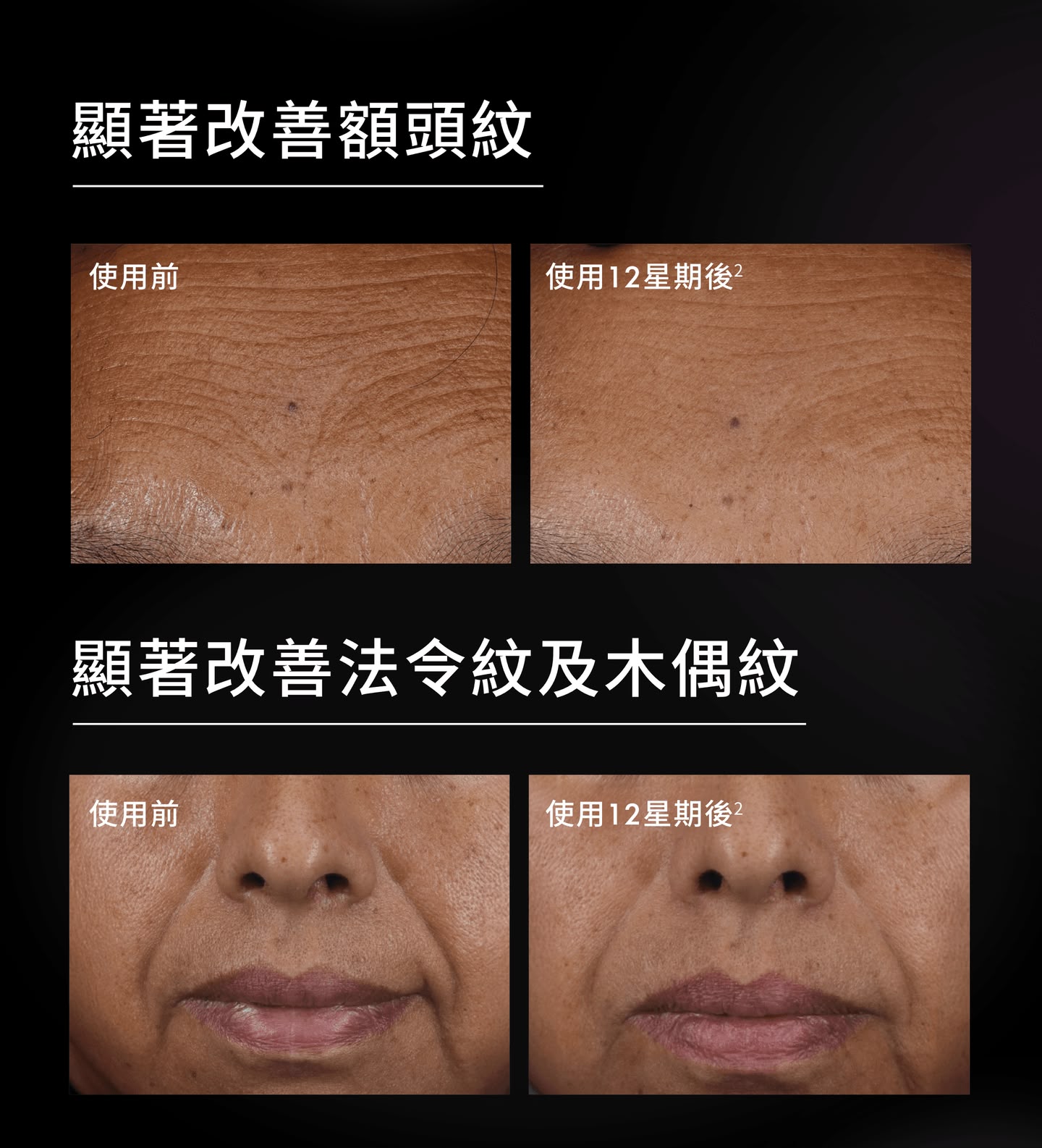 【SkinCeuticals】塑顏飽滿緊緻精華 30ml