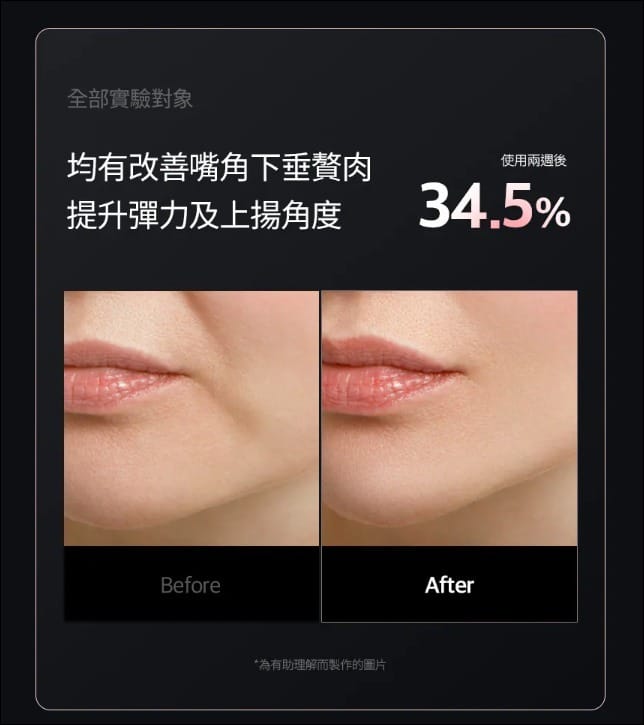 CELLOLOGY CELLNEWMER IRON 皺紋熨斗細胞機