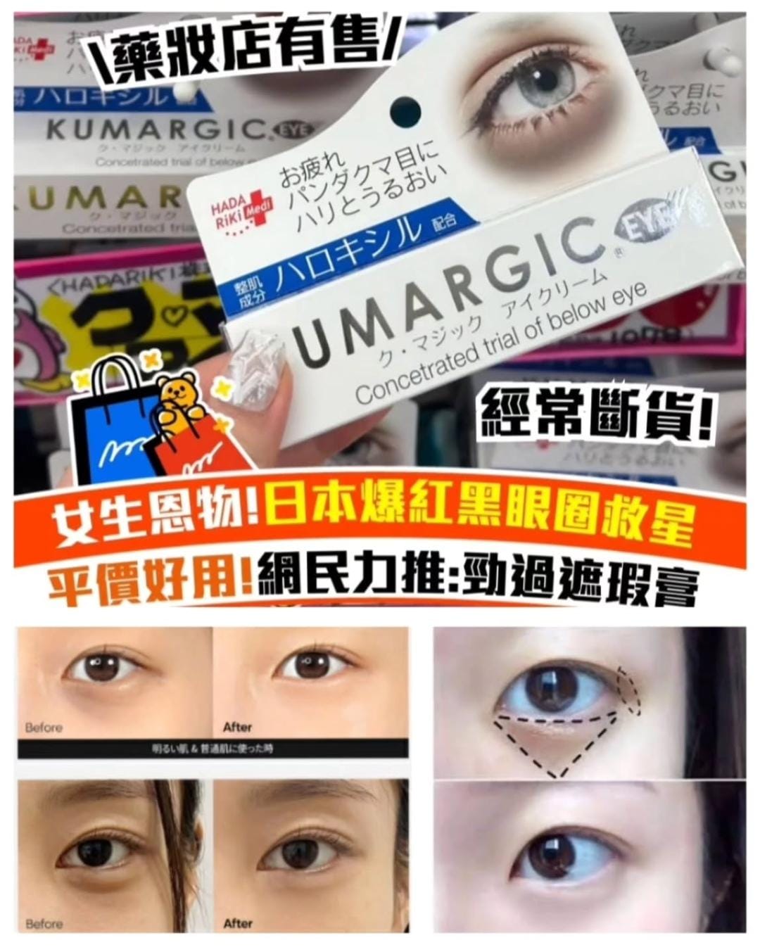 日本製 HADARiKi KUMARGIC EYE 特效去黑眼圈專用眼霜 20g