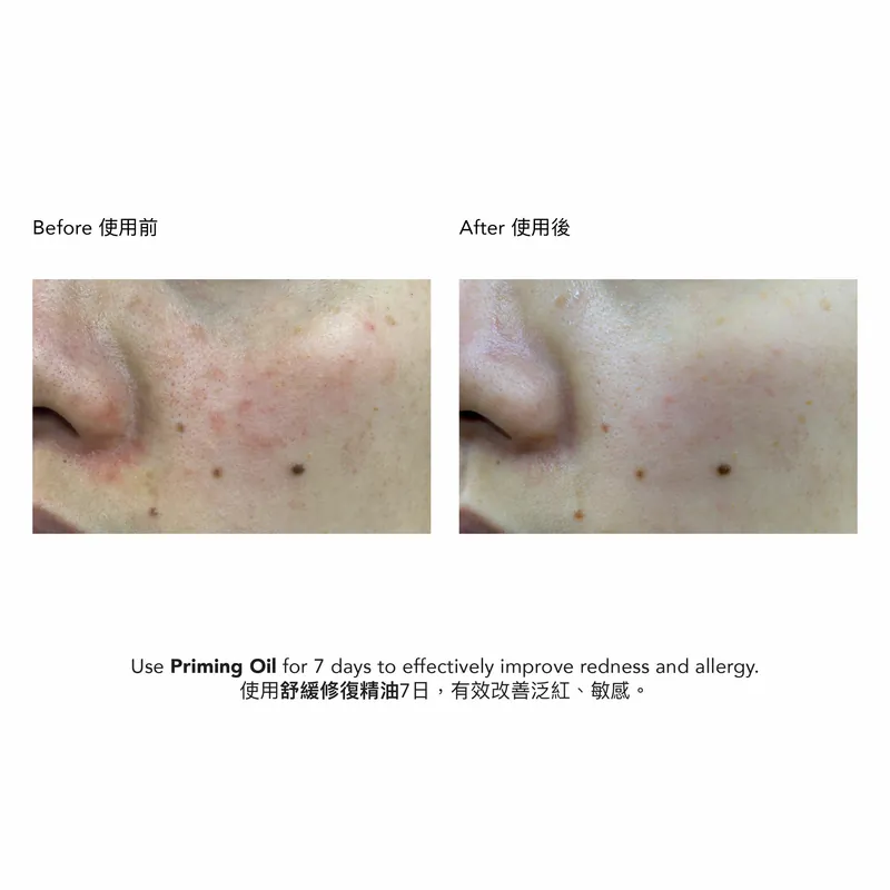 Epionce Priming Oil 舒緩修復精油