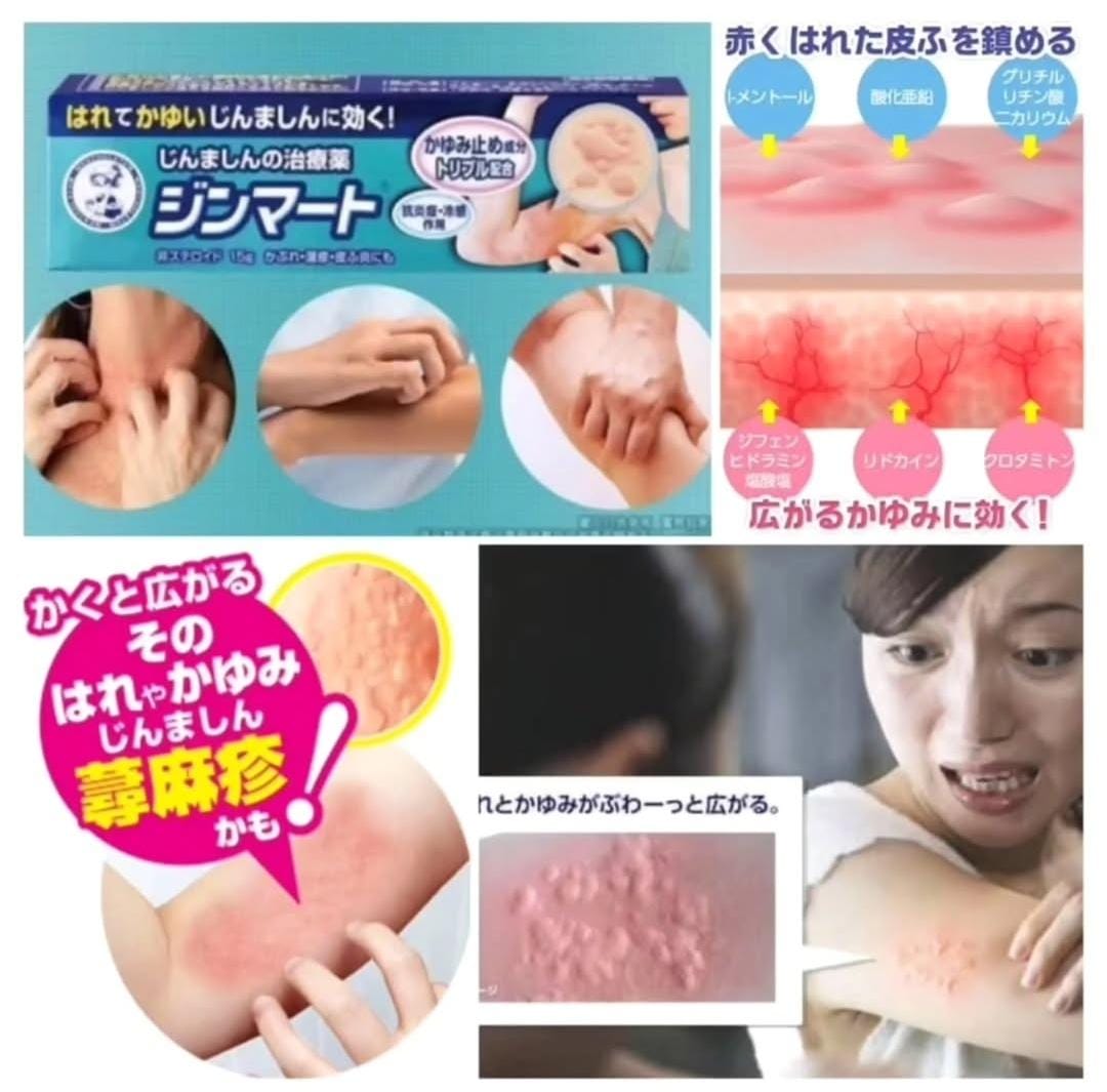 日本曼秀雷敦蕁麻疹濕疹軟膏