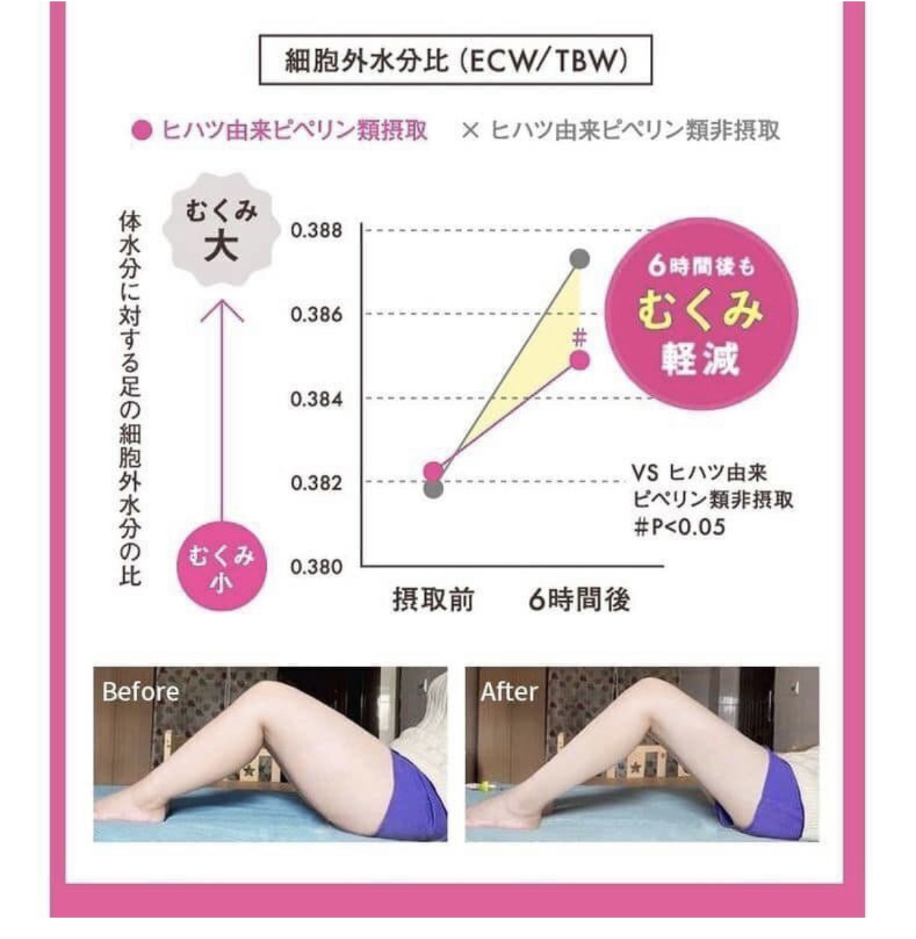 （約3月底到貨）🇯🇵日本製rott's - MeguBio 通淋巴去濕消脂孖寶 套裝 ( 一套三盒 )💕