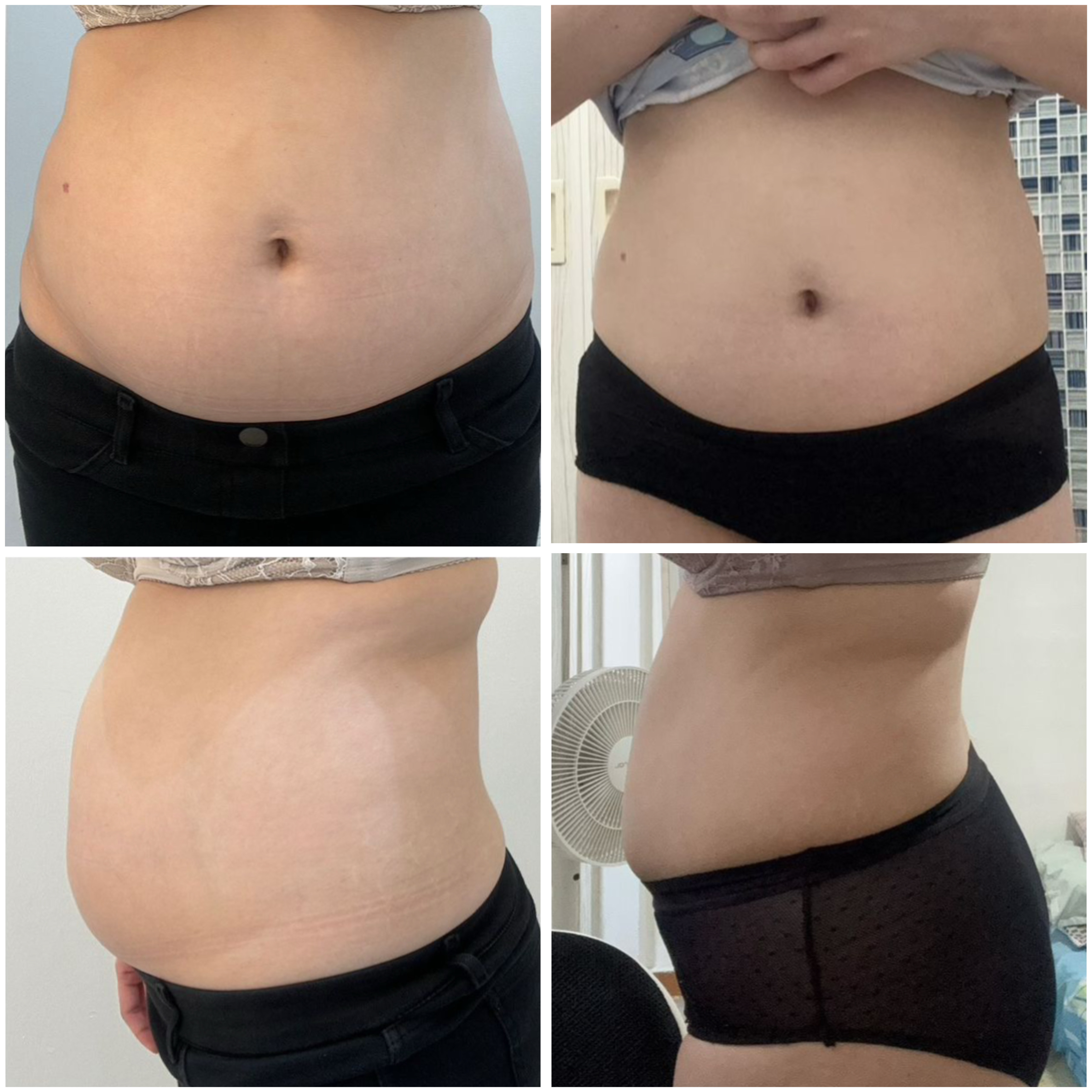 🇲🇾 10 盒 最畅销 VVIP 疗程配套（ 可服用 60-75天 ）