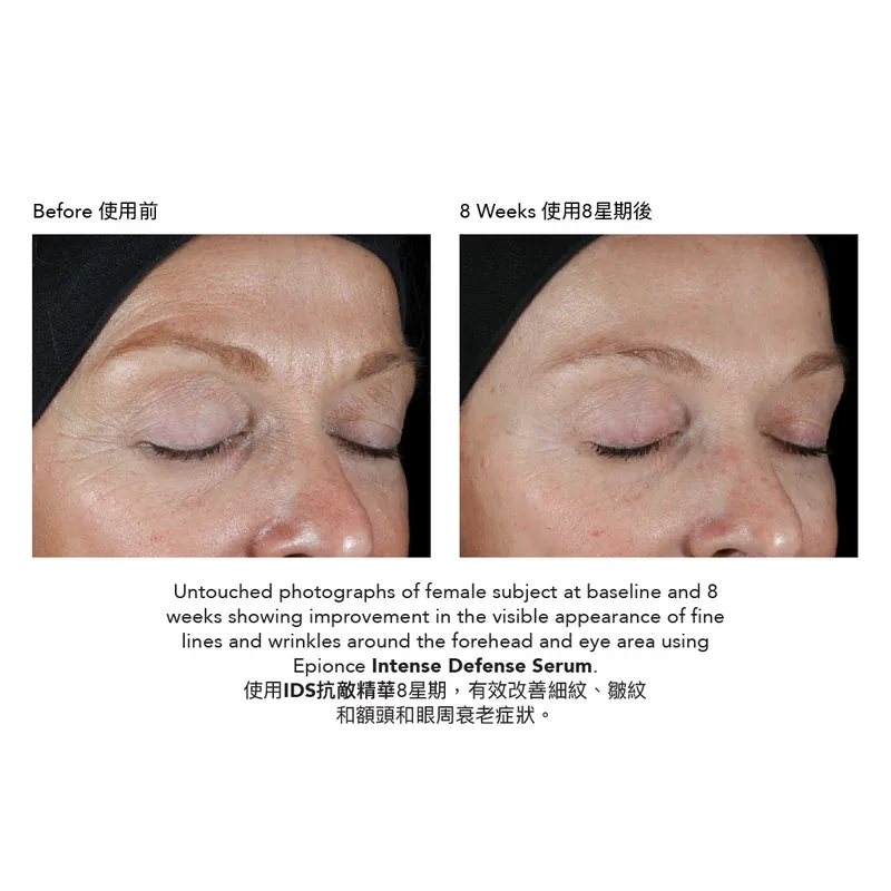 Epionce Intense Defense Serum IDS 抗敵精華