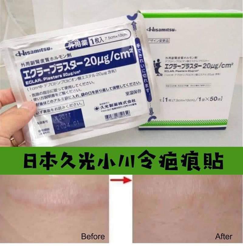 日本Hisamitsu久光去疤貼|處方級蟹足腫剖腹產去疤神器