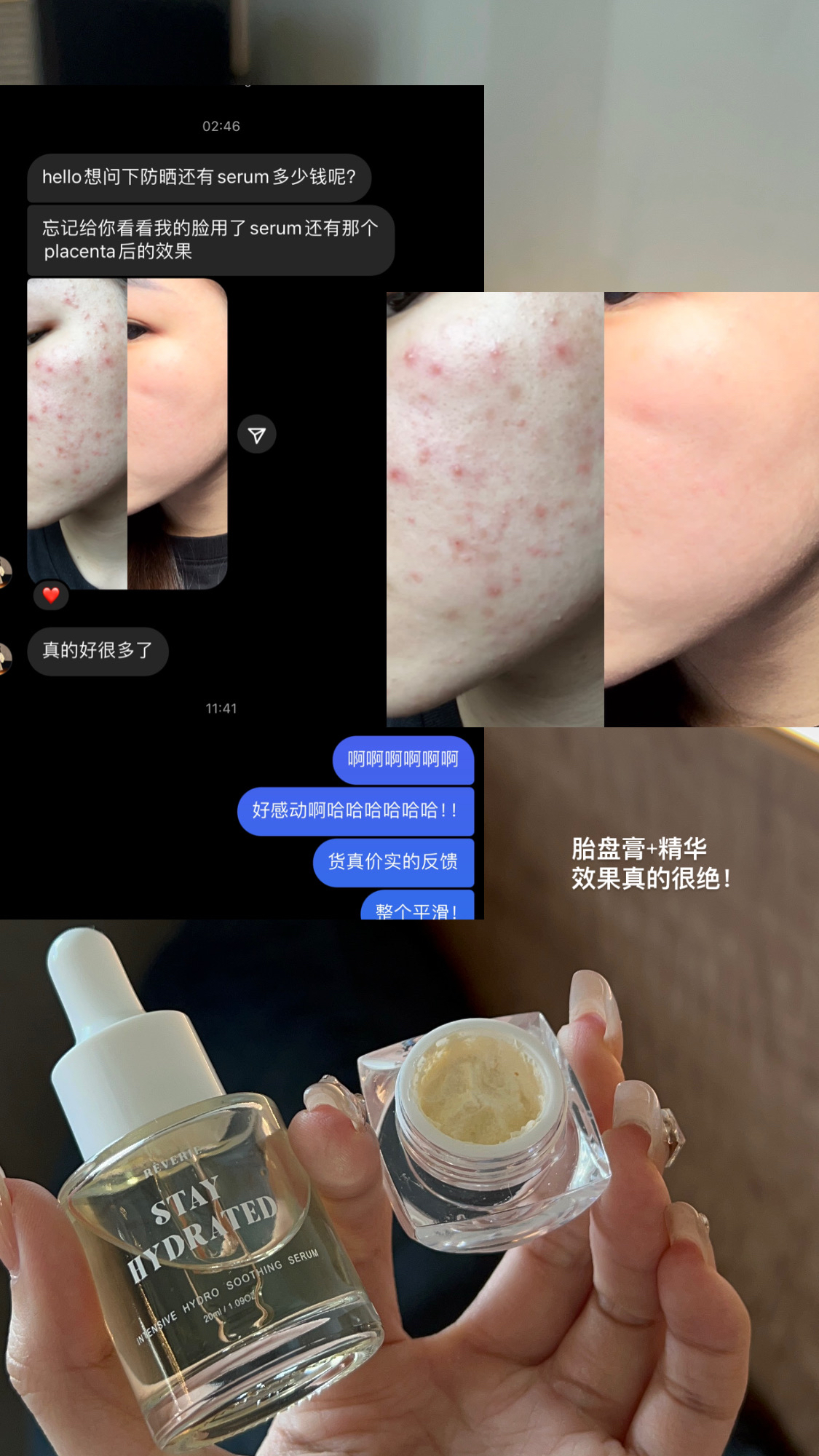 精华+胎盘膏组合（最热销）