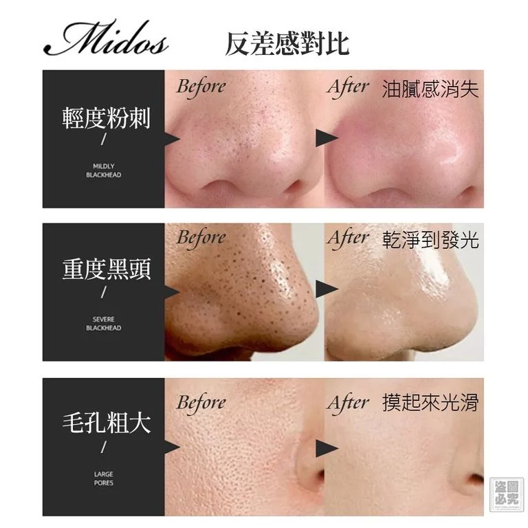 台灣直送 Midso 粉刺導出洗面乳｜買即送導出皂🧼