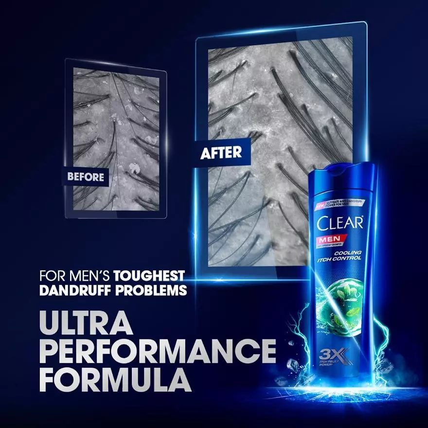 Clear Men Shampoo 170ml - Cooling Itch Control