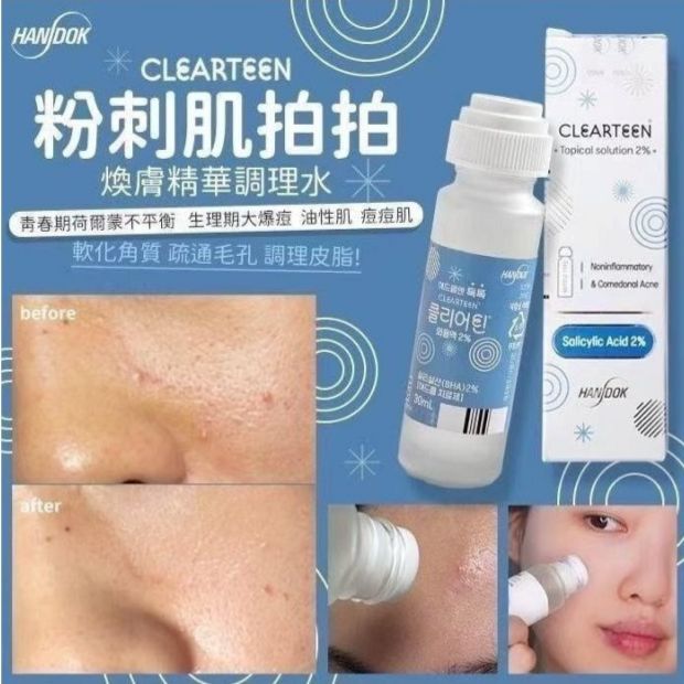 韓國🇰🇷直送✈️HANDOK Acne Clearteen 水楊酸祛痘抗粉刺抗痘水 30ml