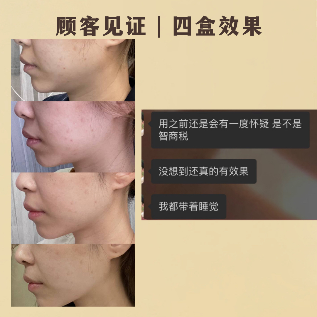 REVERIE瘦脸面膜-热销款