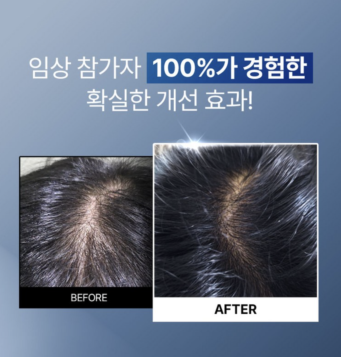韓國 Epais 強韌髮根 頭皮精華 150ml ｜Scalp Boosting Ampoule 