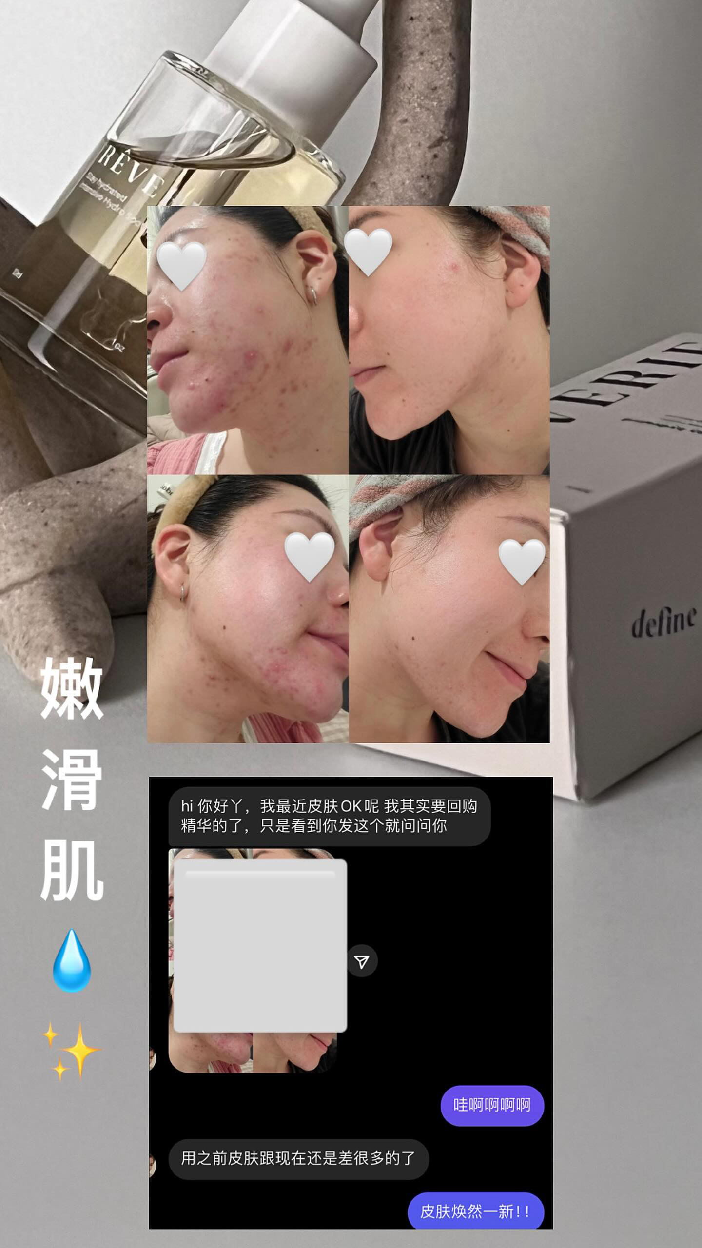 REVERIE补水舒缓精华液