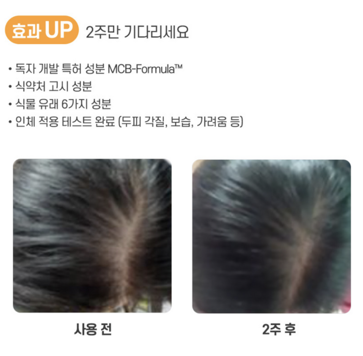 醫學生髮品牌｜韓國  Dr.Graft 植髮皇 生髮防脫 修護 洗髮水 / 精華 ｜Anti-hair Loss & Care Shampoo Tonic 