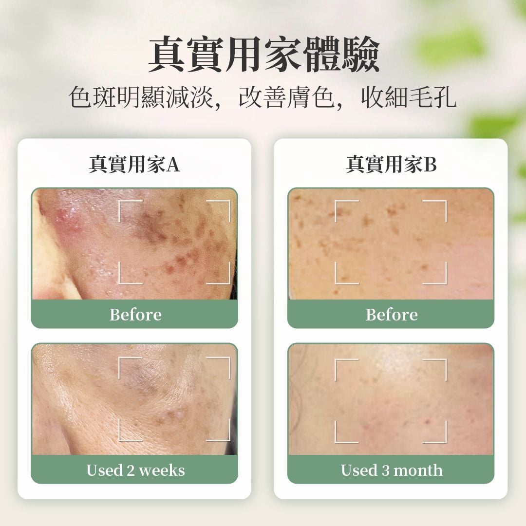 有機VA逆轉肌齡精華 -凈白/去斑/抗皺 e30ml