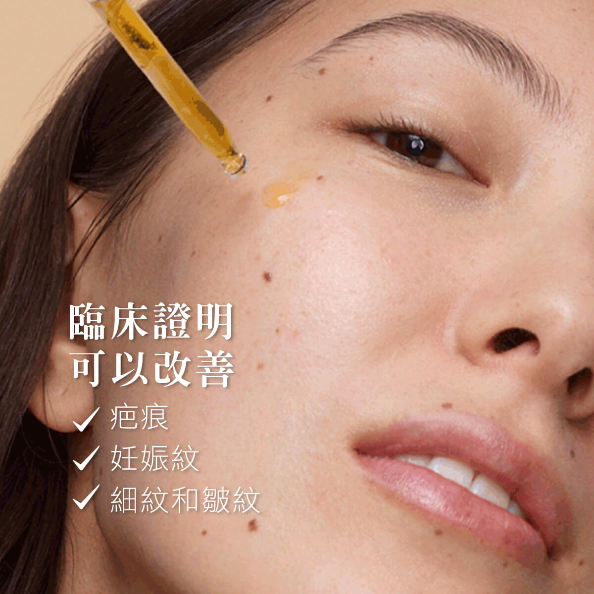 紐西蘭 Trilogy 有機認證玫瑰果油 45ml