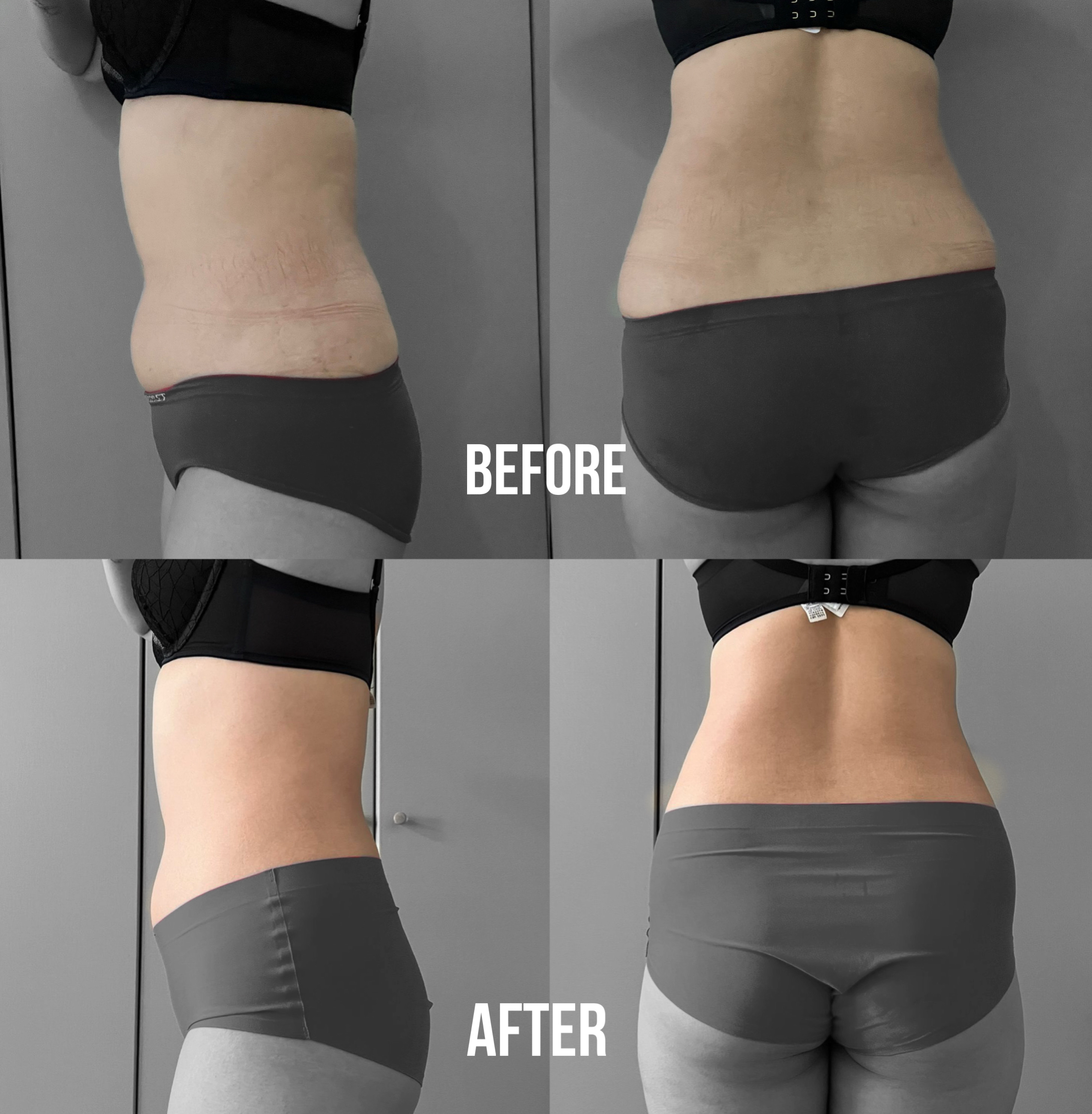 🇲🇾 5 盒 完整一个疗程配套 （ 可服用 30-45 天 ）