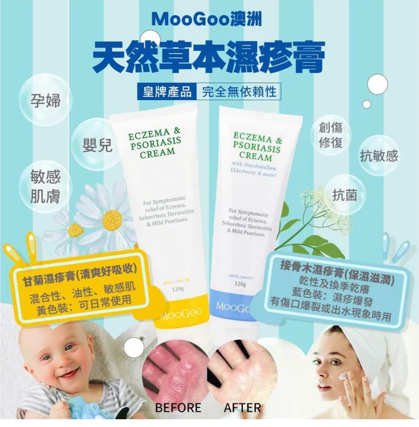 $78支.2支或以上:$68支.MooGoo 澳洲天然草本濕疹膏 120g