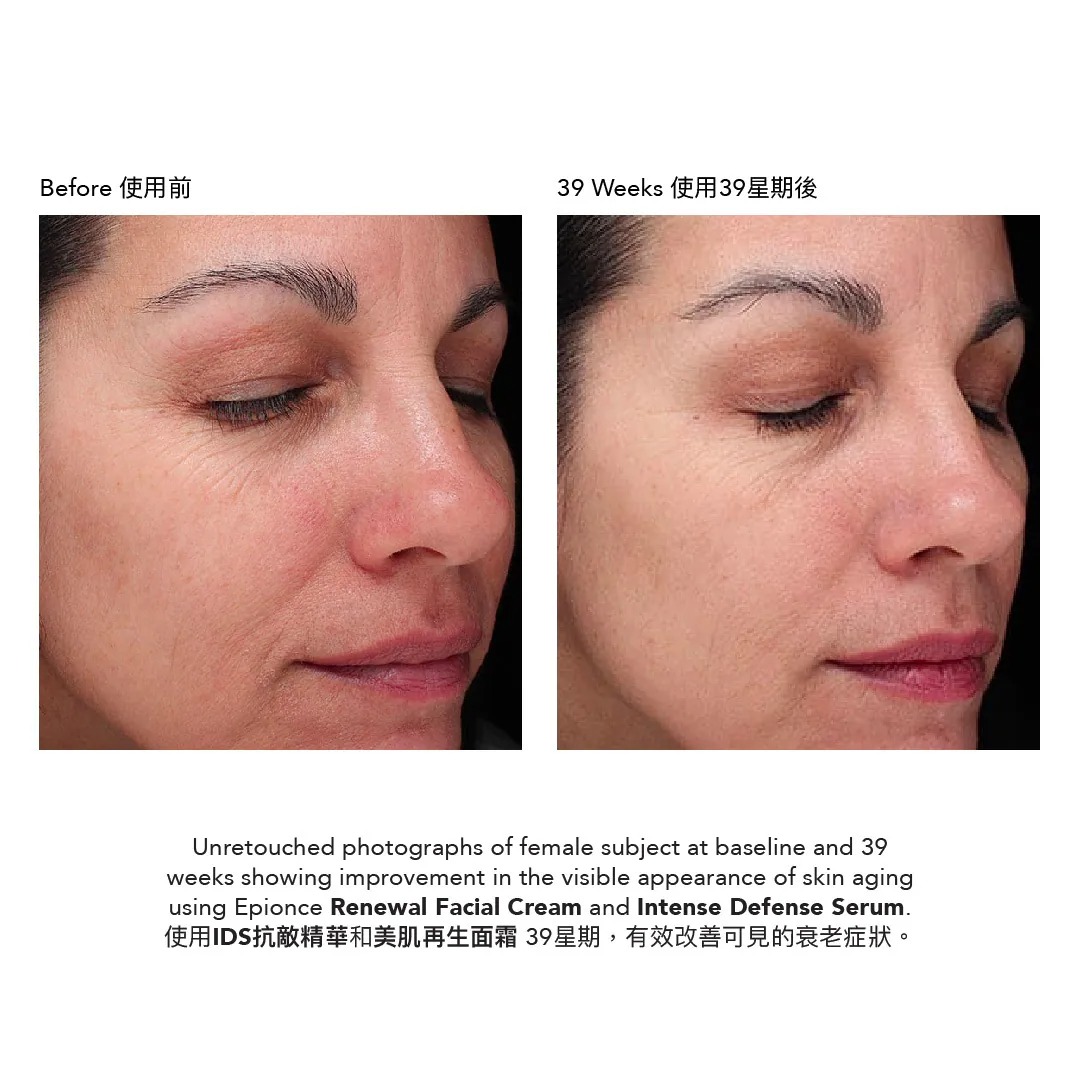 Epionce Renewal Facial Cream 美肌再生面霜