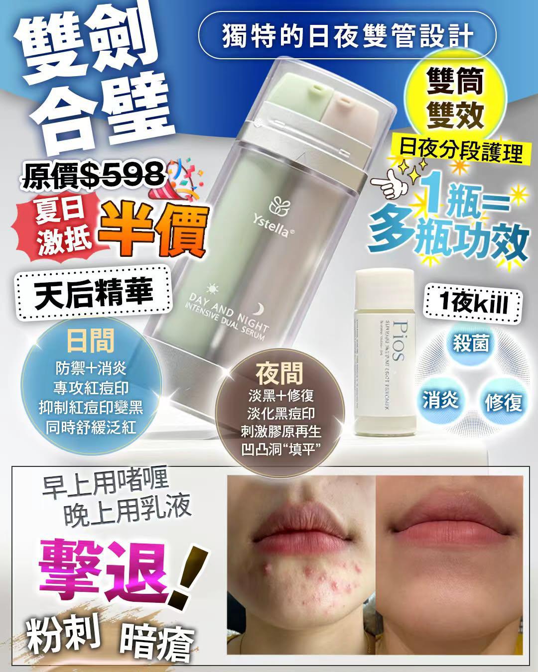 天后精華 +  暗瘡水  