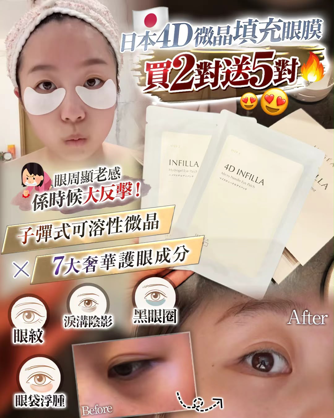 日本 HASÉA 4D INFILLA 微晶填充眼膜｜淡化眼紋黑眼圈