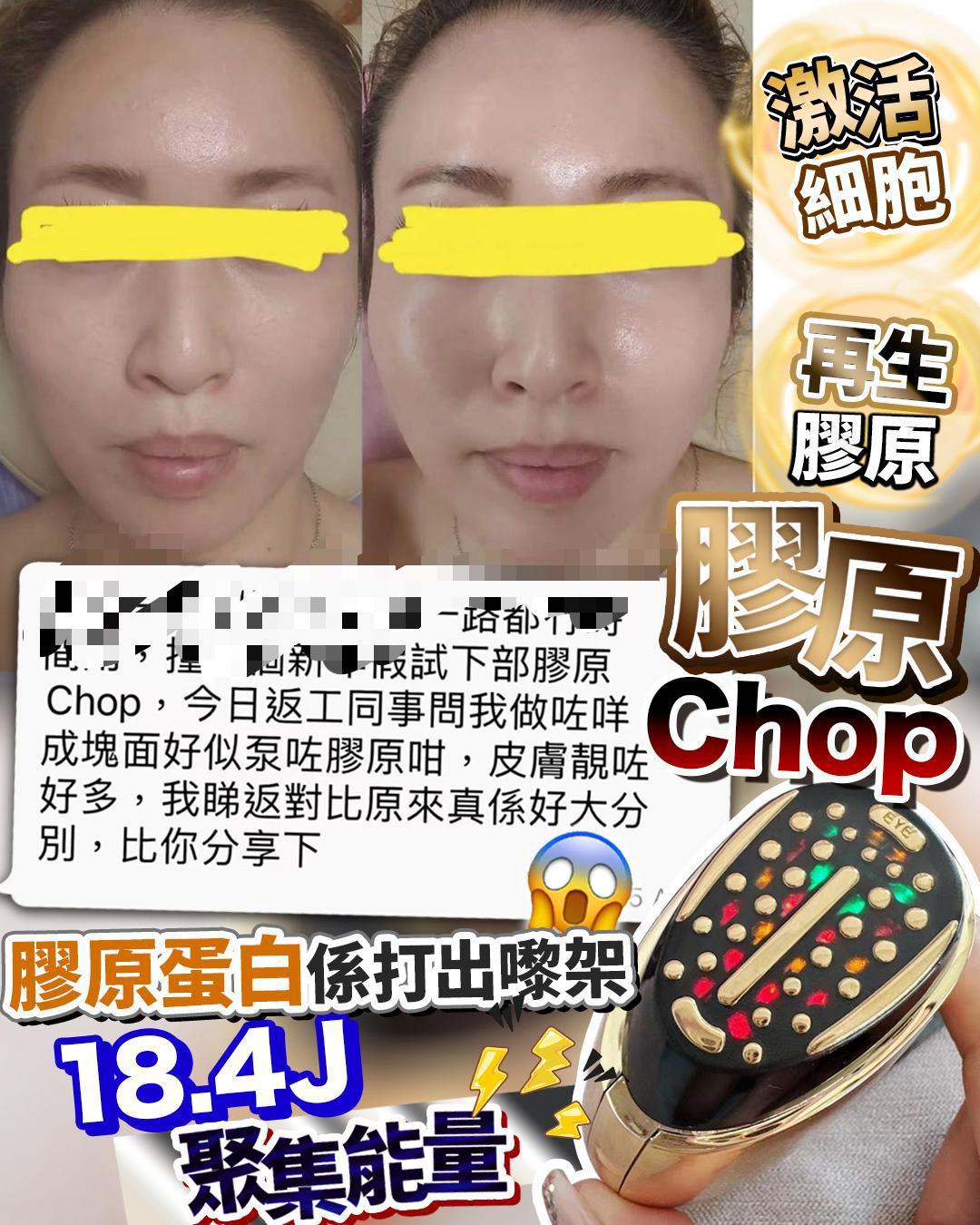 MYLA’S 膠原Chop V3 PRO小金蛋❤️送10片 蓋章式專用膠原面膜   