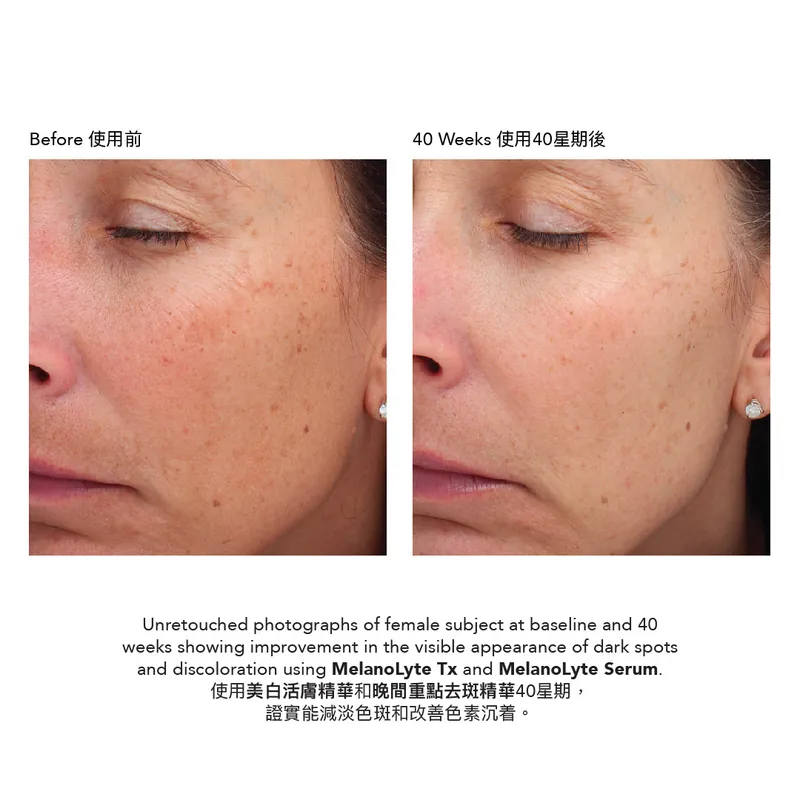 Epionce MelanoLyte Tx Brightening Lotion 美白活膚精華