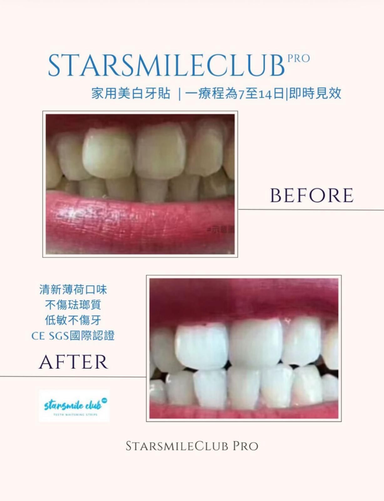 𝐒𝐭𝐚𝐫𝐬𝐦𝐢𝐥𝐞𝐂𝐥𝐮𝐛 𝐏𝐫𝐨 專業🇺🇸美白牙齒貼 （7p) ✅ 現貨 ✅ ‼️ 售完即止‼️
