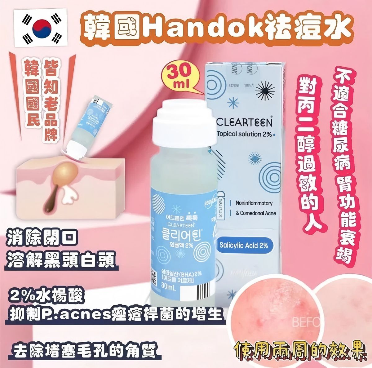 韓國🇰🇷直送✈️HANDOK Acne Clearteen 水楊酸祛痘抗粉刺抗痘水 30ml