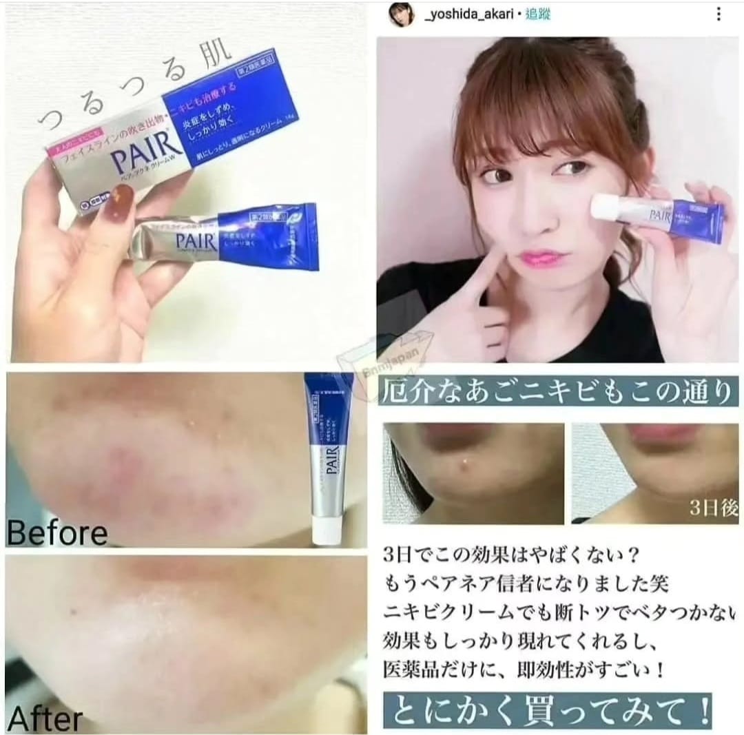 日本Pair暗瘡膏24g