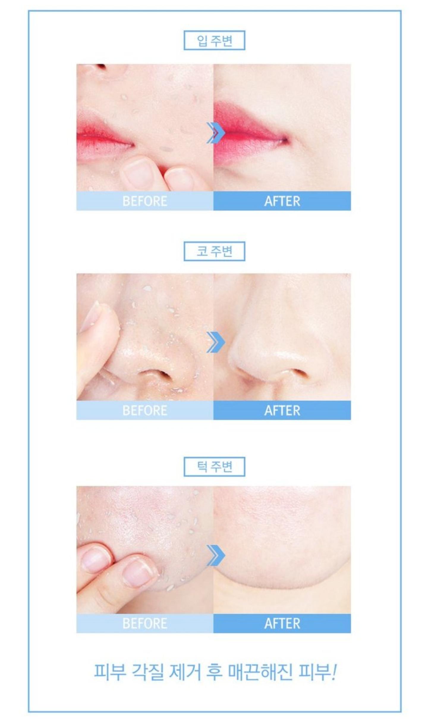 RiRe All Kill Refresh Peeling Gel溫和去除角質嫩膚凝膠