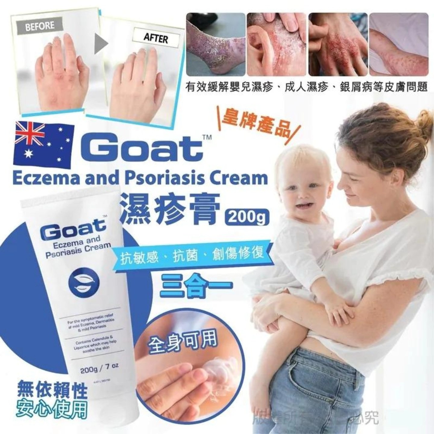 Goat Eczema And Psoriasis Cream 濕疹膏 200g