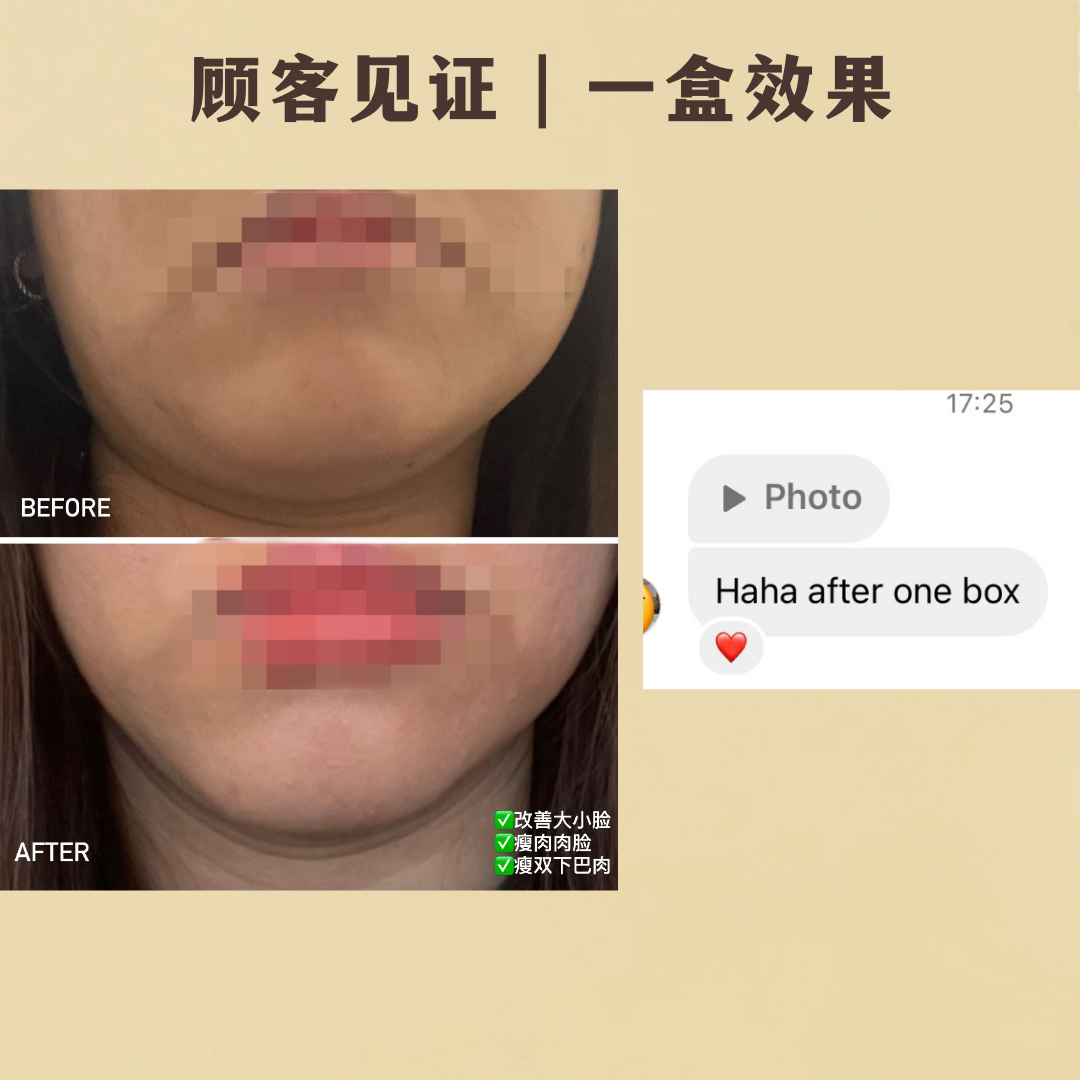 REVERIE瘦脸面膜-热销款