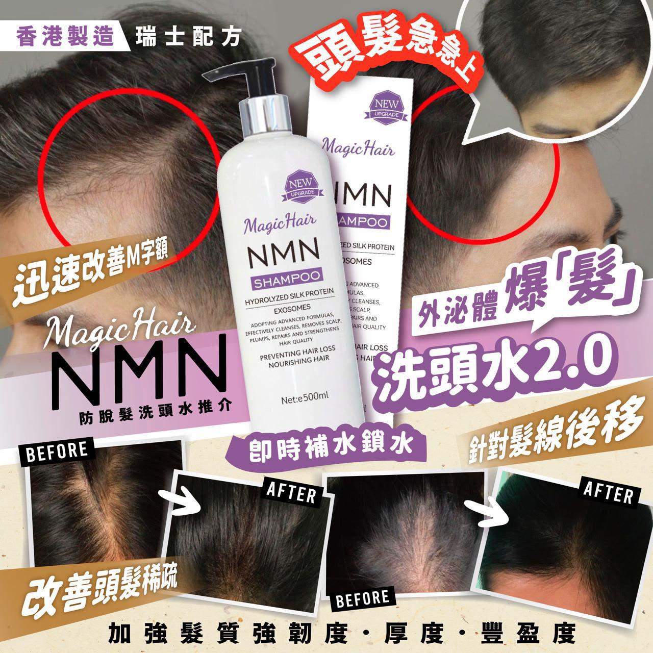 Magic C NMN 外泌體爆「髮」洗頭水2.0