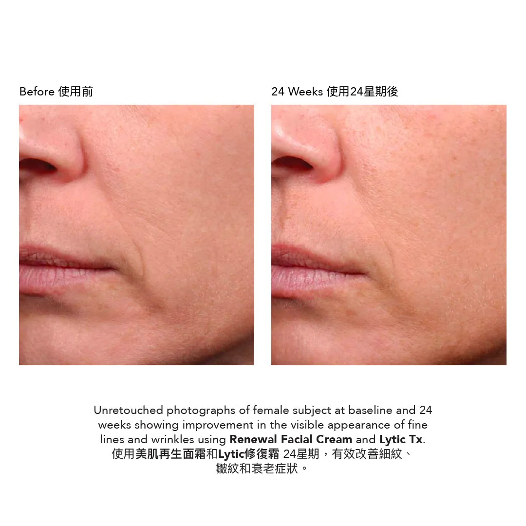 Epionce Lytic Tx Retexturizing Lotion 修復霜