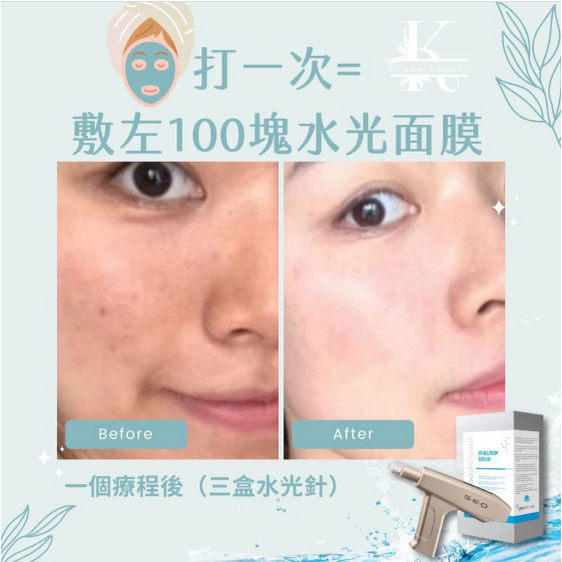 【 Geoskincare CH Team 消費券專享優惠 】家用無痛納米水光槍新手入門套装