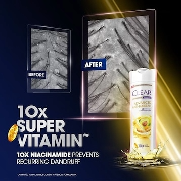 Clear Women Shampoo 300ml Advance Anti-Hairfall