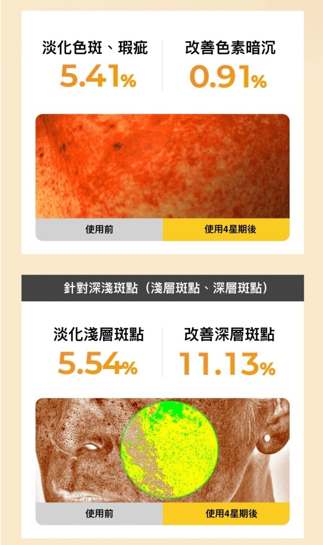 韓國🇰🇷直送✈️RIRE TRANEX 煥白淡斑精華霜10g