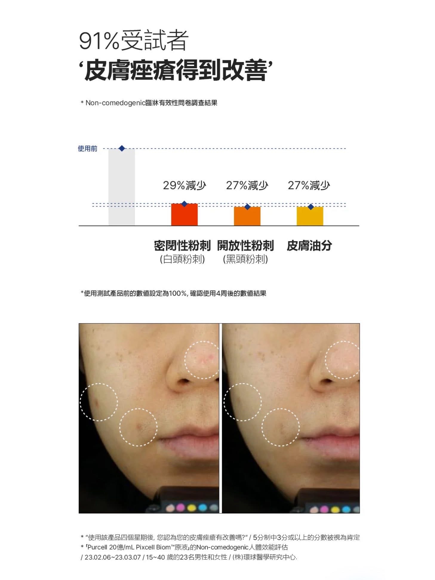 PURCELL PIXCELL BIOM™ 2BILLON/ml Ampoule  20億/mL乳酸菌鎮靜舒緩原液安瓶 30ml 