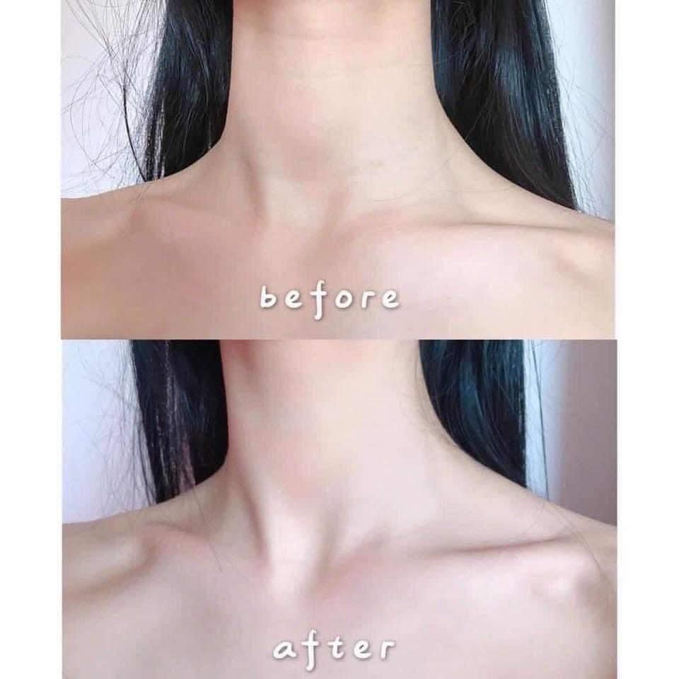 韓國🇰🇷VELLA 深層撫紋熨斗頸膜(5gx5片)一盒