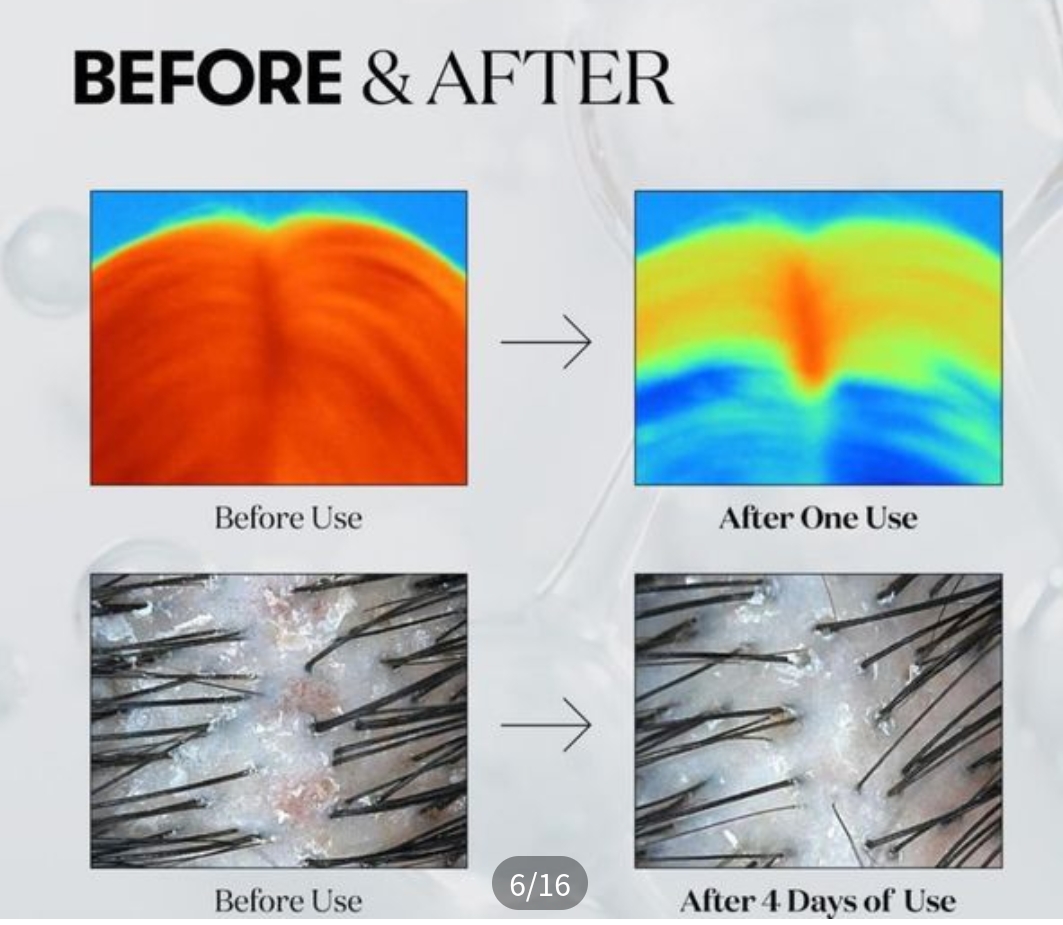 韓國 VT PDRN Reedle Shot 700dL 頭皮護理精華 15ml | 700微針導入 | PDRN強效育髮 | 防脫密髮