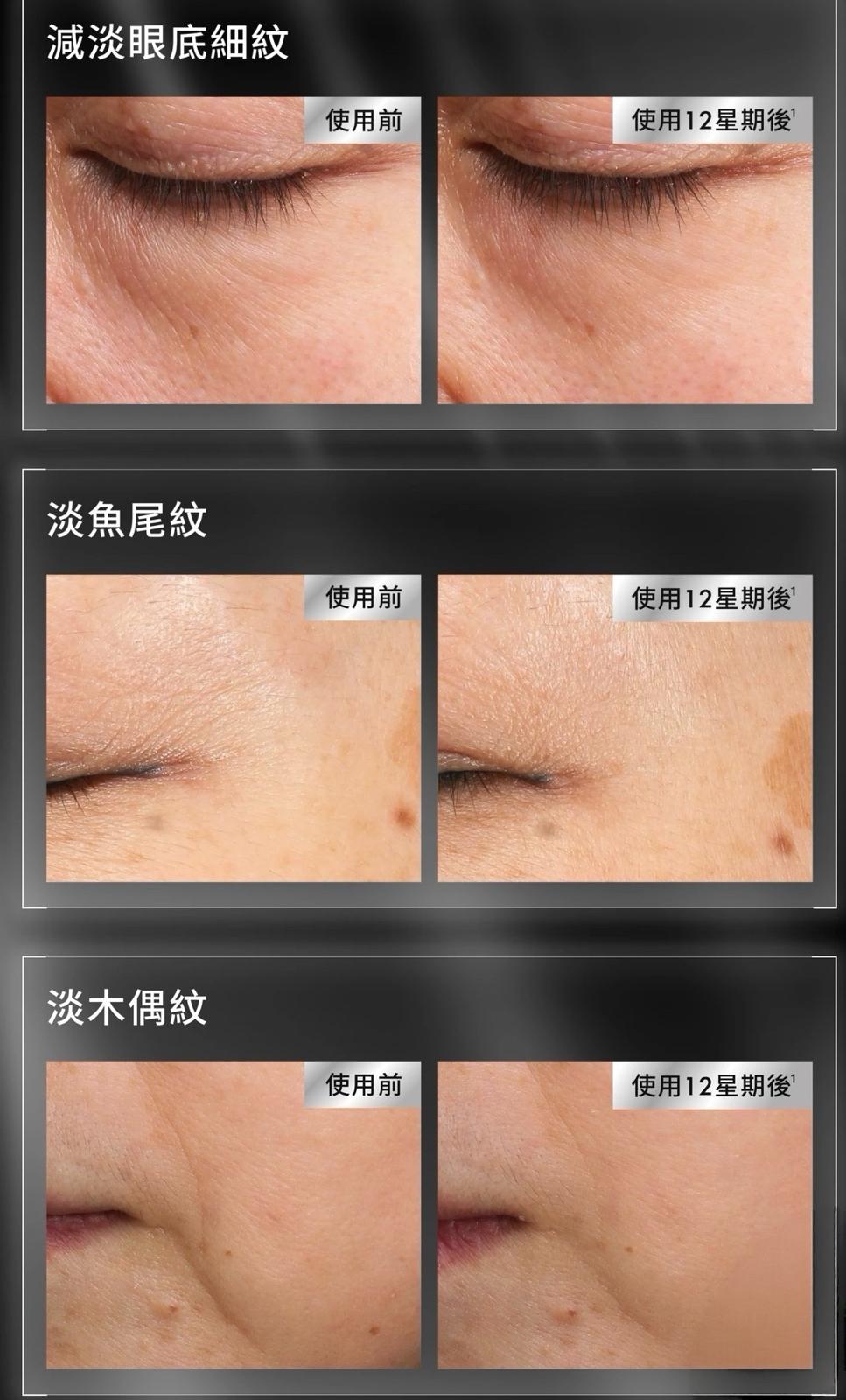 今批平💢💢 🆕新品 Skin Ceuticals P-TIOX 多肽肉毒桿菌精華 💥💥15ml 💥💥 