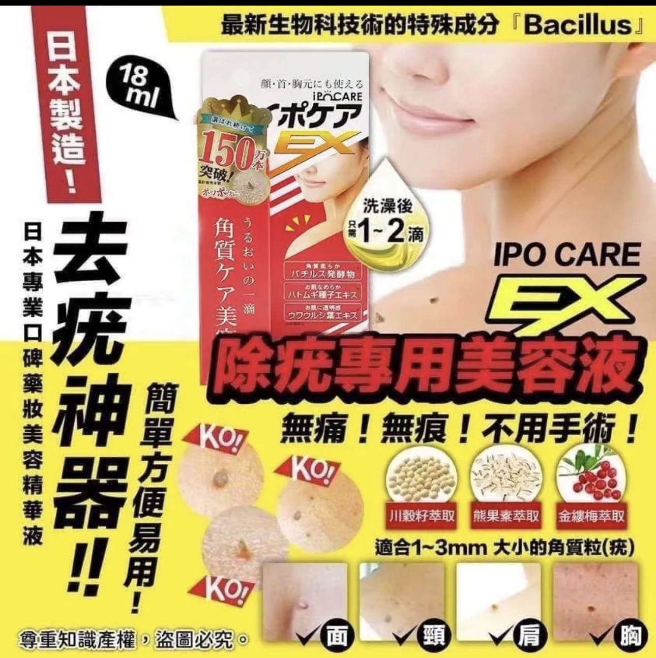 1-2星期到貨❤️Ipocare - EX 除疣專用美容液 (強效去疣膏)