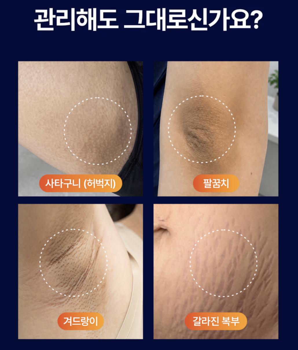 拒絕黑關節｜韓國 Mommy Care Orthotamin 醫學級 高純度 純維C 美白身體乳 300g / 支｜Vitamin C Body Cream