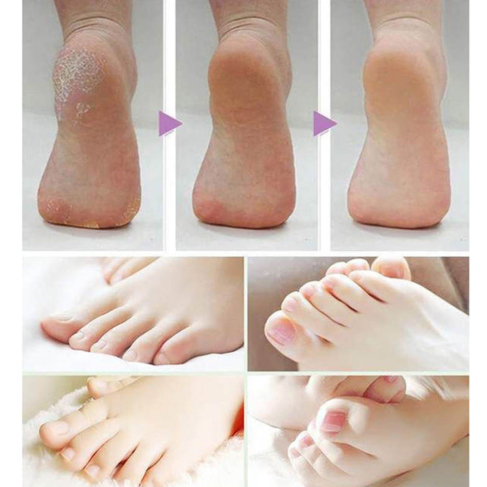 1件 磨腳器磨頭 磨砂頭 電動磨腳器替換頭 去死皮修腳機磨頭 磨足替換砂頭磨頭 修足機 磨腳器 修腳 磨腳神器 石磨頭磨砂頭替換 HG0933