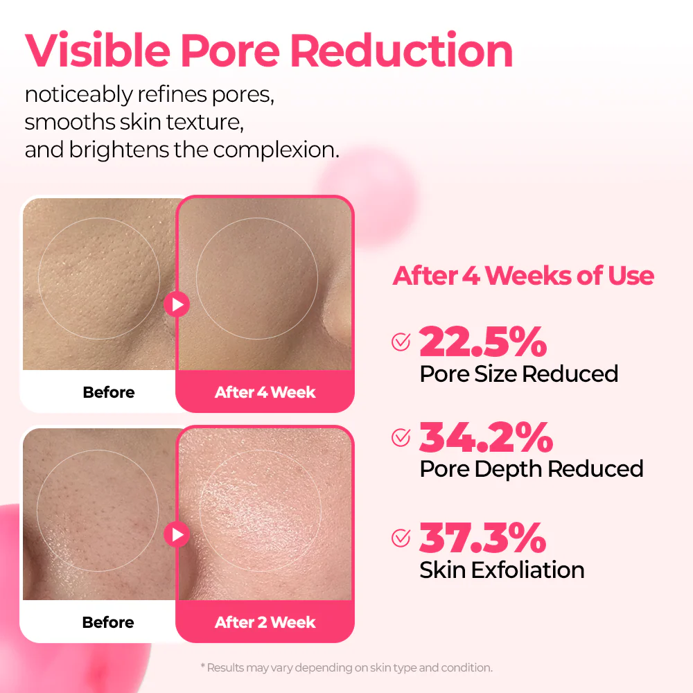 Dr.Melaxin Cemenrete Cyano Pink Spicule Serum (Cemenrete 粉紅微針緊緻精華) (30ml)