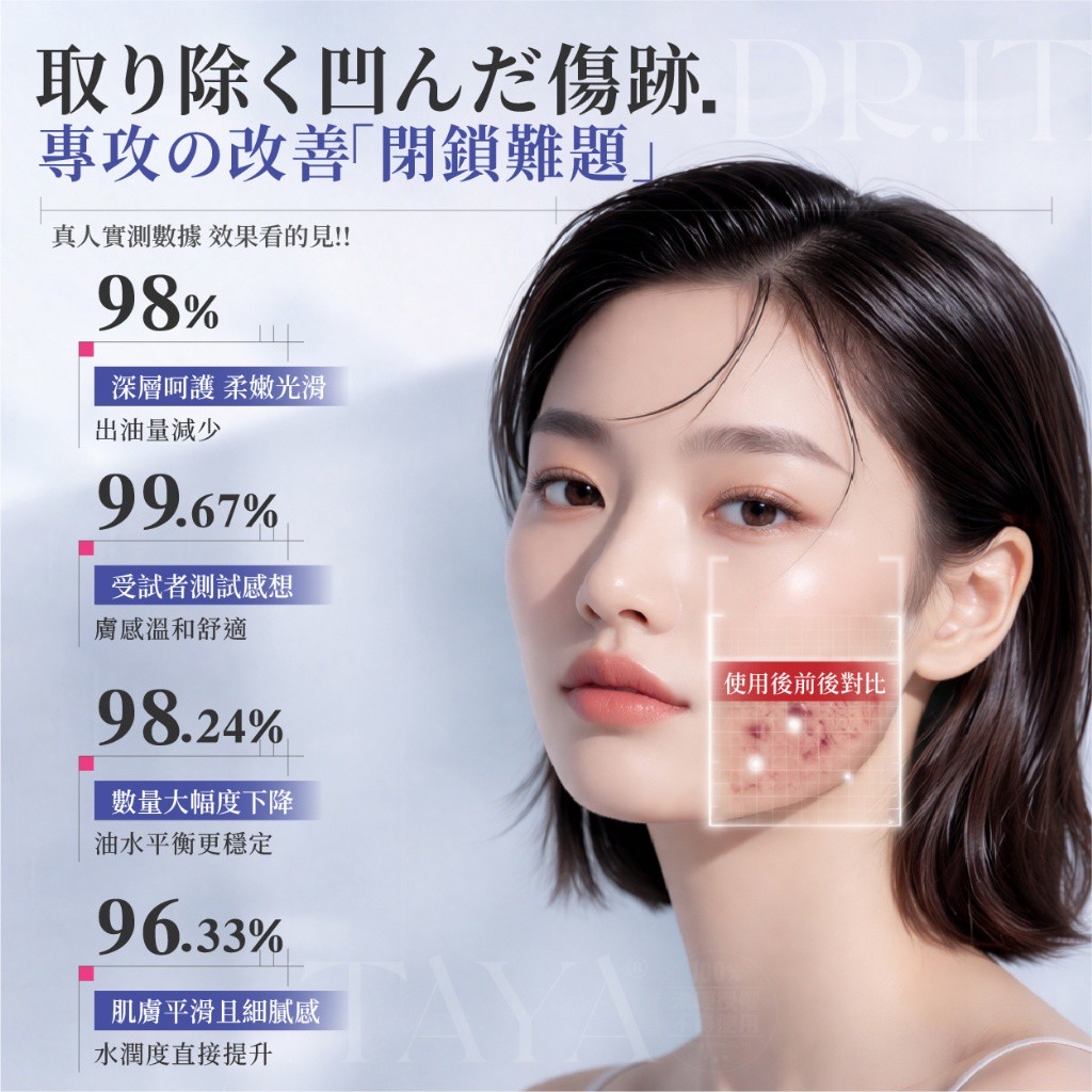 *DR.ITAYA®️ Acne 袪荳軟膏 30ml*