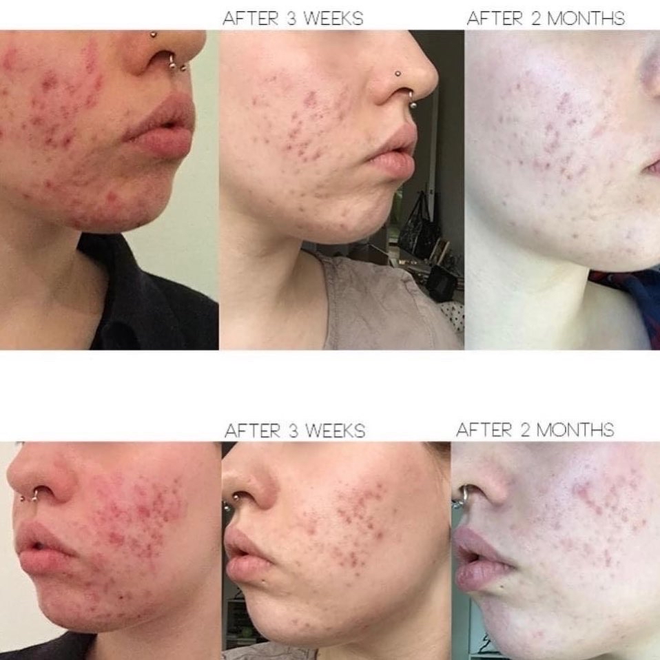 韓國 COSRX 酵母 精華神仙水 乳糖95 膚色均衡 100ml｜Galactomyces 95 Tone Balancing Essence